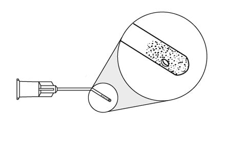 CAPSULE POLISHER, 0.3 MM SIDE- PORT,