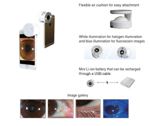 QuikVue Adaptor smartphone imaging